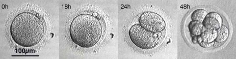 media/module10/developbismorula.jpg