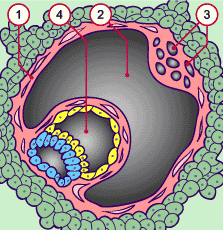 media/module10/f2t_implant14j3.gif