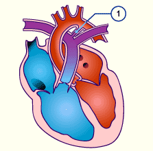 media/module16/p10b_pda.gif