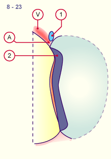 media/module16/p1e_pericardinout8.gif