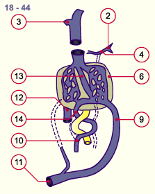 media/module16/p6b3_VenenUmbilical18.gif