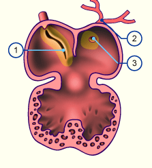 media/module16/p6c2_Pulm13.gif