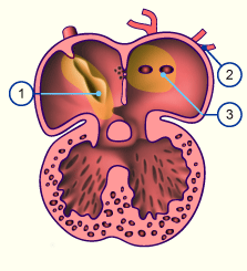 media/module16/p6c3_Pulm14.gif