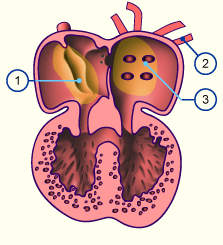 media/module16/p6c4_Pulm15.gif