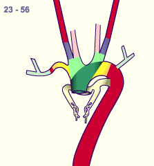 media/module16/p7_Aortenbogen23.gif