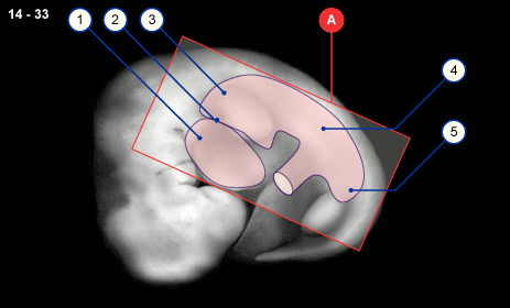 media/module18/r4c_zoelom14_kyoto.gif