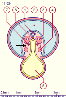 media/module20/t2b_cstad11_29.gif