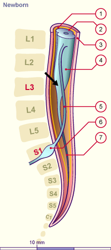 media/module22/v5j3_moelle.gif