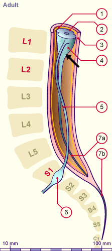 media/module22/v5j4_moelle.gif