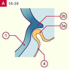 media/module22/v7f_adenohypo_st16.gif