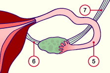 media/module4/d1m_eiabnahmeb.gif