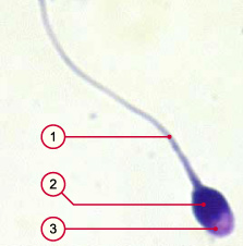 media/module4/d2a_spermiumnormal.jpg