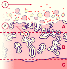 media/module6/g1b_desquam.gif