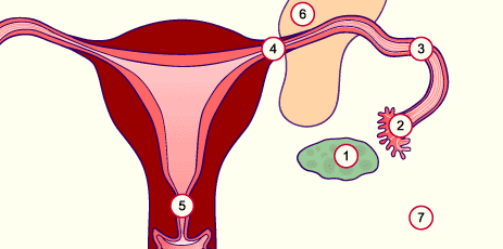 media/module6/g4a_ectopique.gif