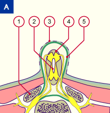 media/module7/h6c_myelomeningo_b.gif