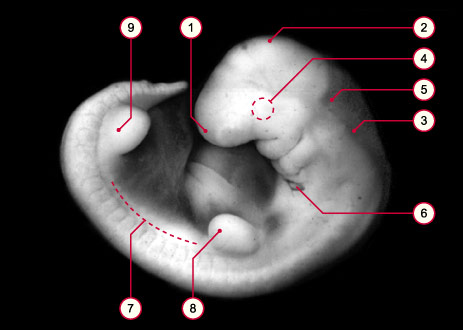 media/module8/carnegie/i1_kyotostad14.jpg