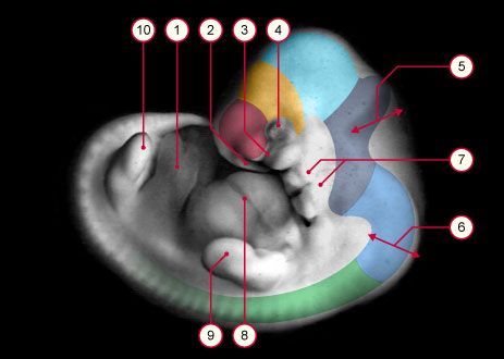 media/module8/carnegie/i1_kyotostad16.jpg