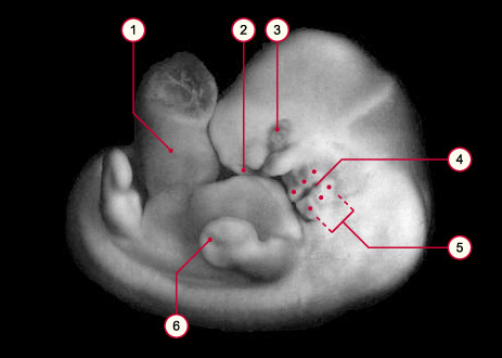 media/module8/carnegie/i1_kyotostad17.jpg