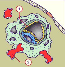 media/multuse/f2l_implant10j1.gif