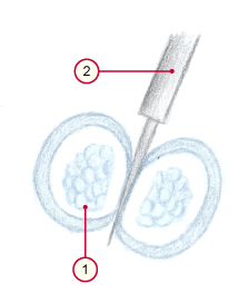 media/vet/module4/emb_splitting.jpg