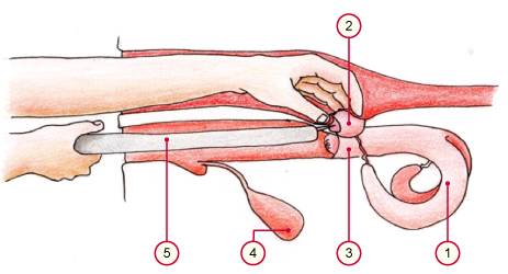 media/vet/module4/ovum_pickup.jpg