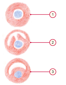 media/vet/module9/Implantationstypen.jpg