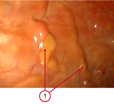 media/vet/module9/endometrial_cup.jpg