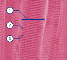 media/module14/m2e_histoquer1.gif