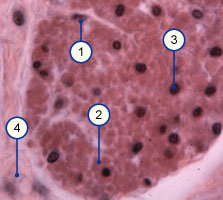 media/module14/m5b_histoglatquer1.jpg