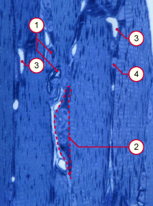 media/module14/musc_junction.jpg