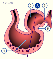 media/module16/p2c2_sagittalN.gif