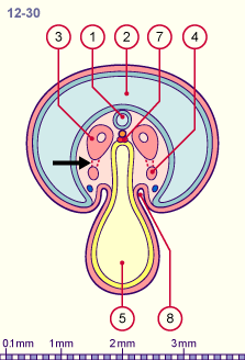 media/module20/t2c_cstad12_30.gif