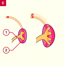 media/module20/t4b2_calices.gif