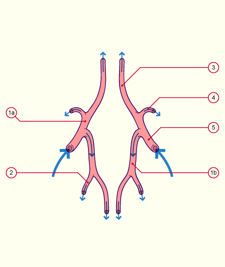 media/module22/v11c_circulcereb_1.gif