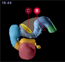 media/module22/v7a_planB_st18.gif