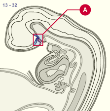 media/module22/v7f_adenohypo_planA.gif