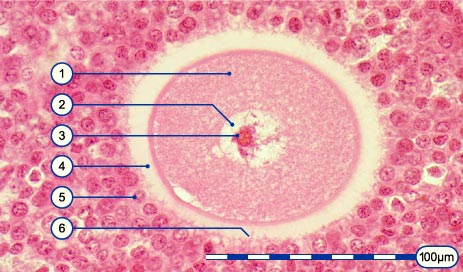 media/module3/3_2_eizelleinovar.jpg