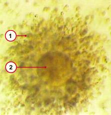 media/module4/d0a_EizCorona.jpg