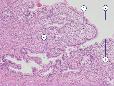 media/module4/d3d_cervixdruesen.jpg