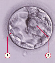 media/module5/e1h_blastobern.jpg