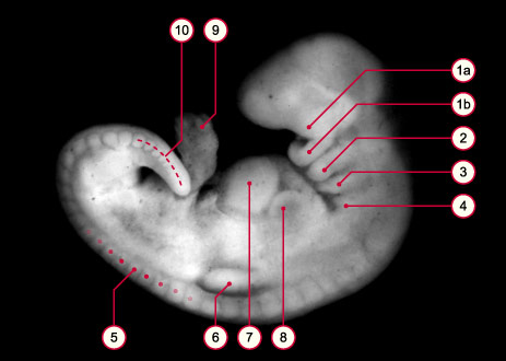 media/module8/carnegie/i1_kyotostad13.jpg