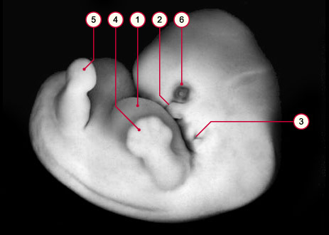 media/module8/carnegie/i1_kyotostad18.jpg