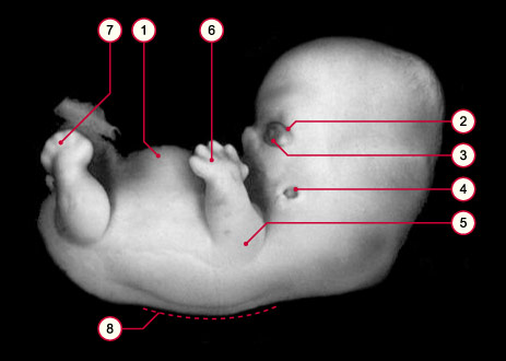 media/module8/carnegie/i1_kyotostad19.jpg