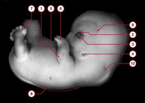 media/module8/carnegie/i1_kyotostad20.jpg