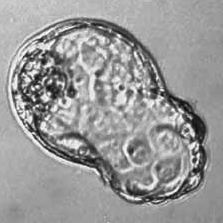 blastocyst hatching