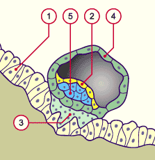 media/multuse/f2h_implant7j1.gif