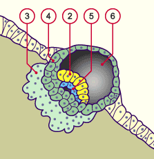 media/multuse/f2i_implant7j2.gif