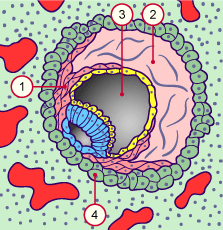 media/module10/f2n_implant11j3.gif