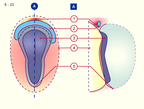 media/module16/p1_pericardfruh8.gif