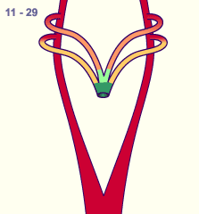 media/module16/p7_Aortenbogen11.gif